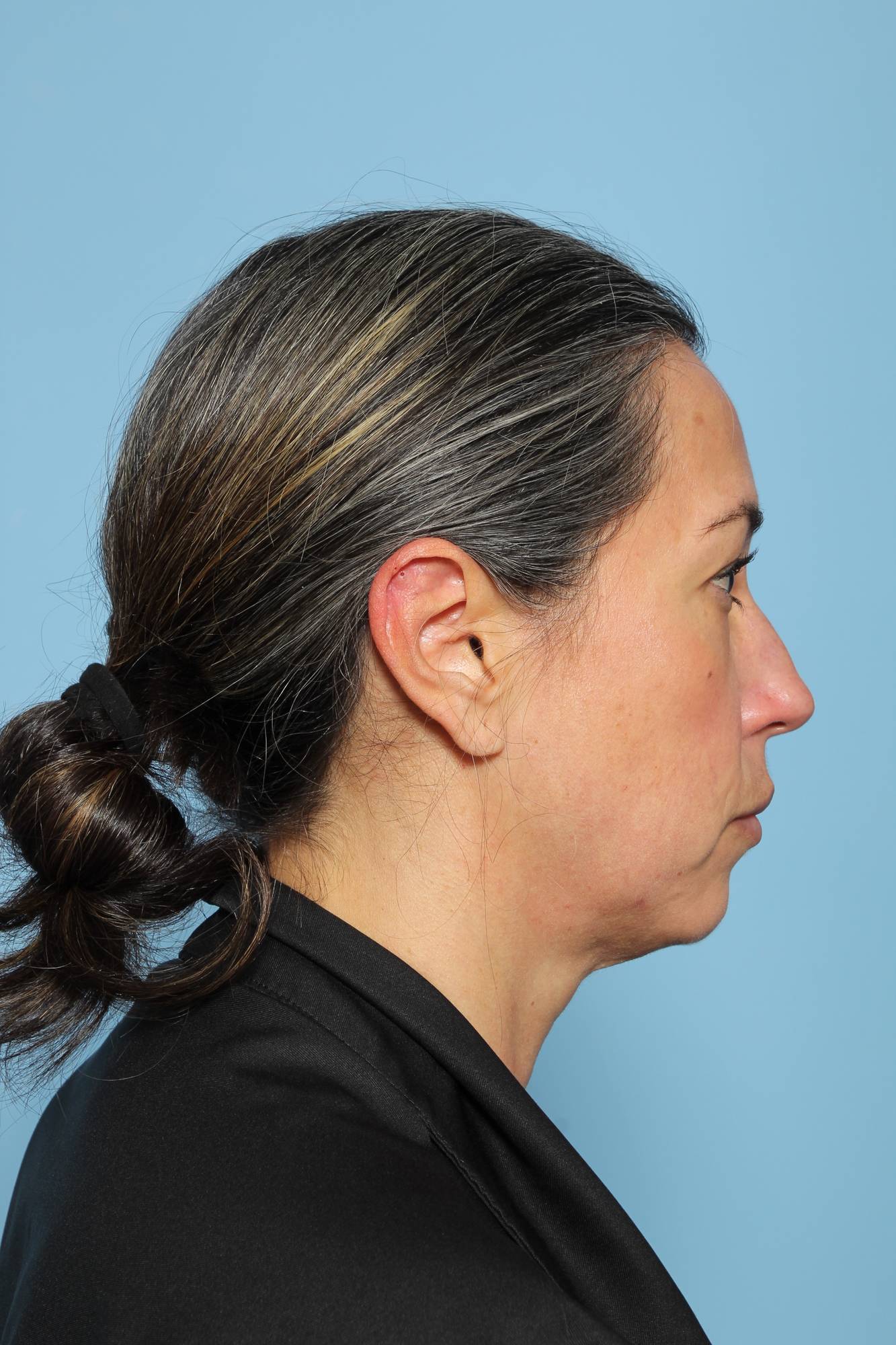 Before & After Image