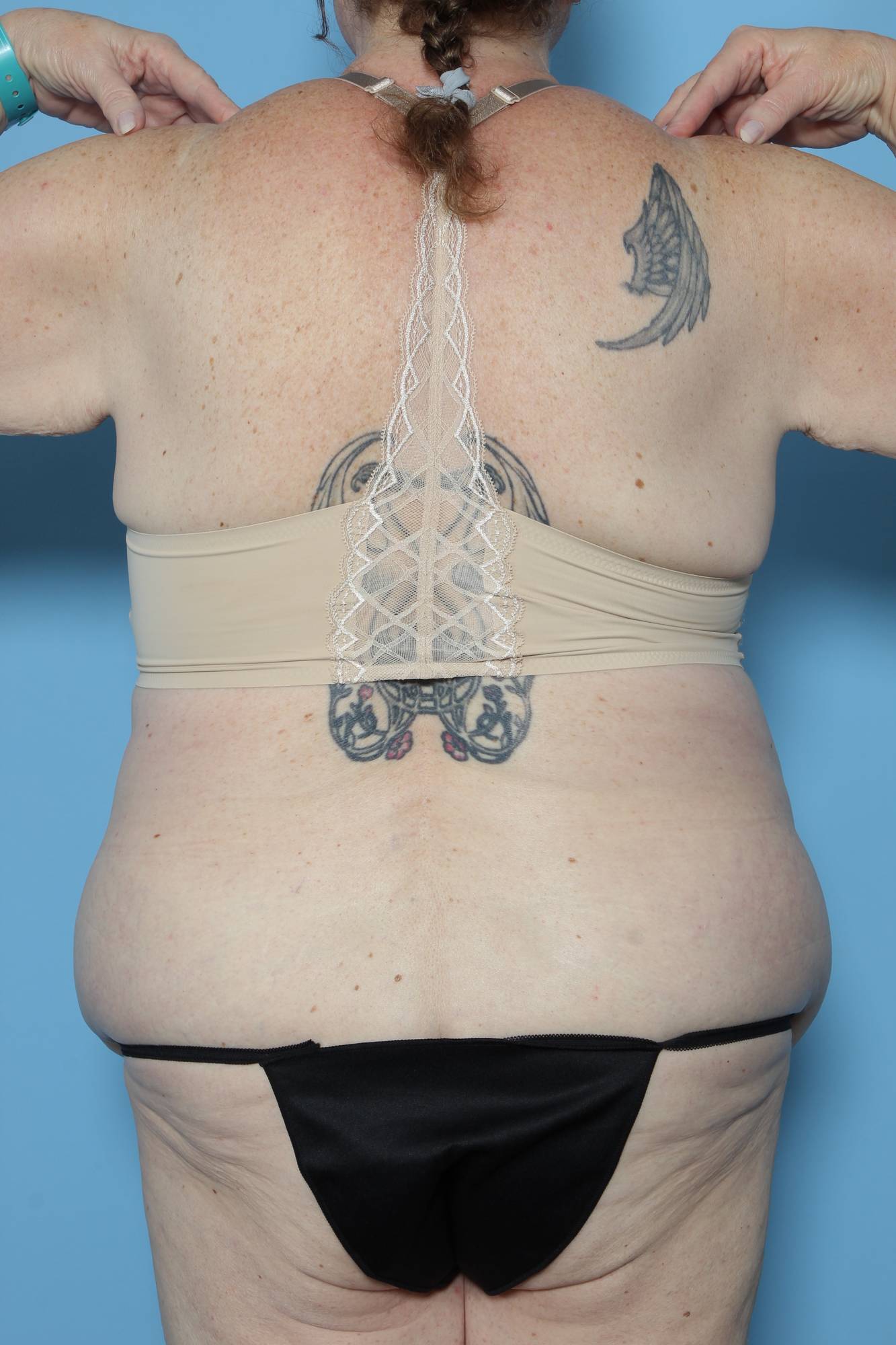 Before & After Image