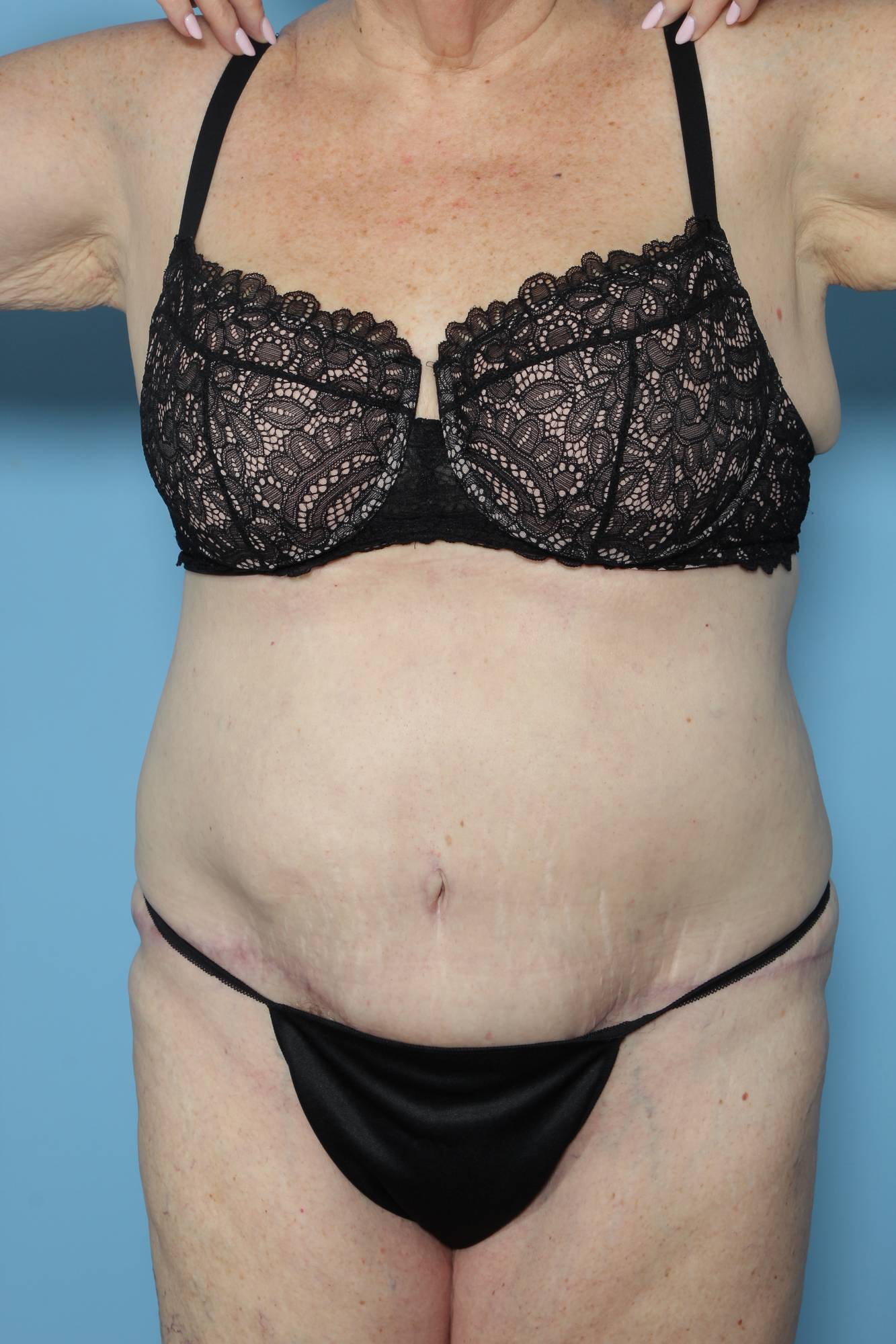 Before & After Image