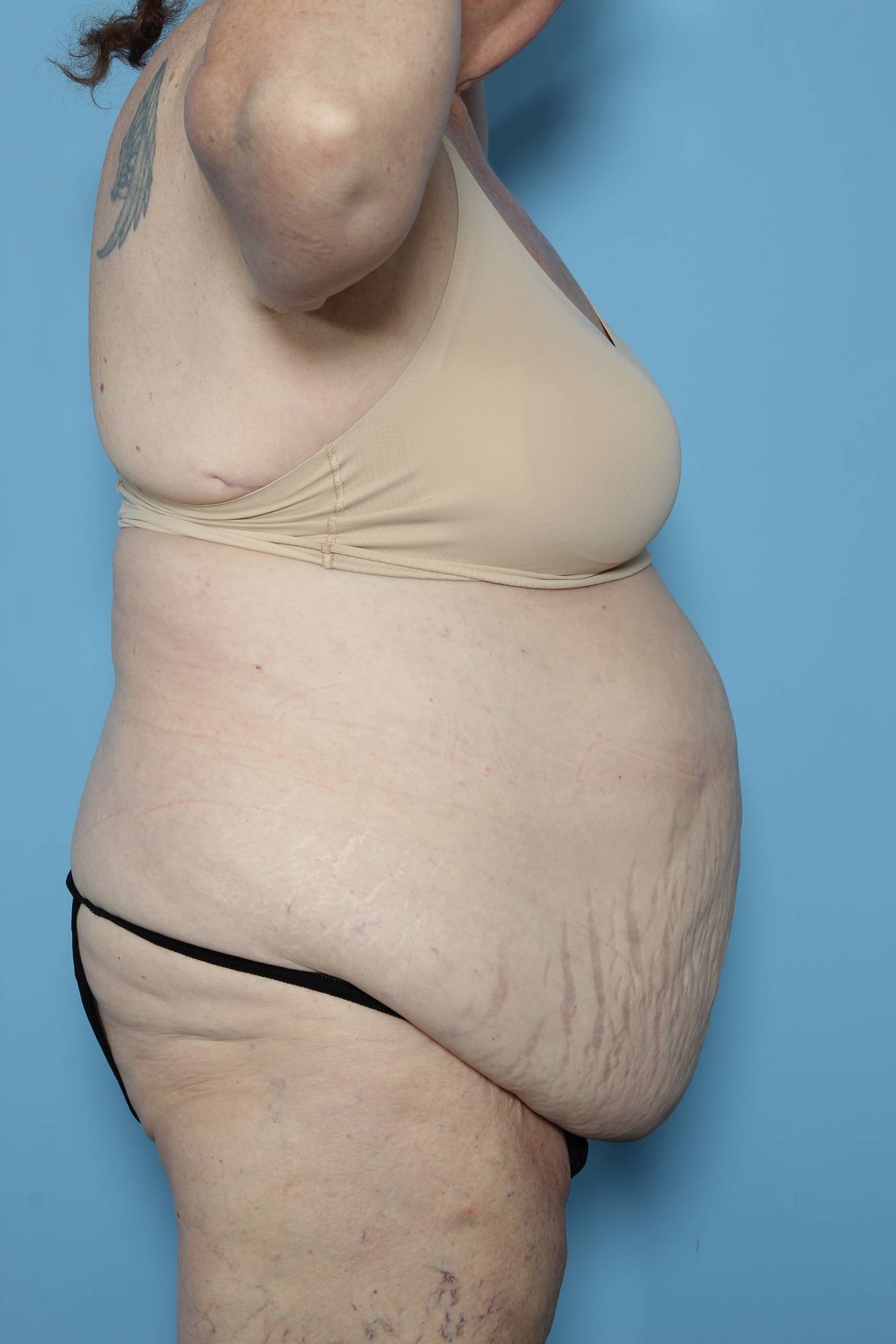 Before & After Image