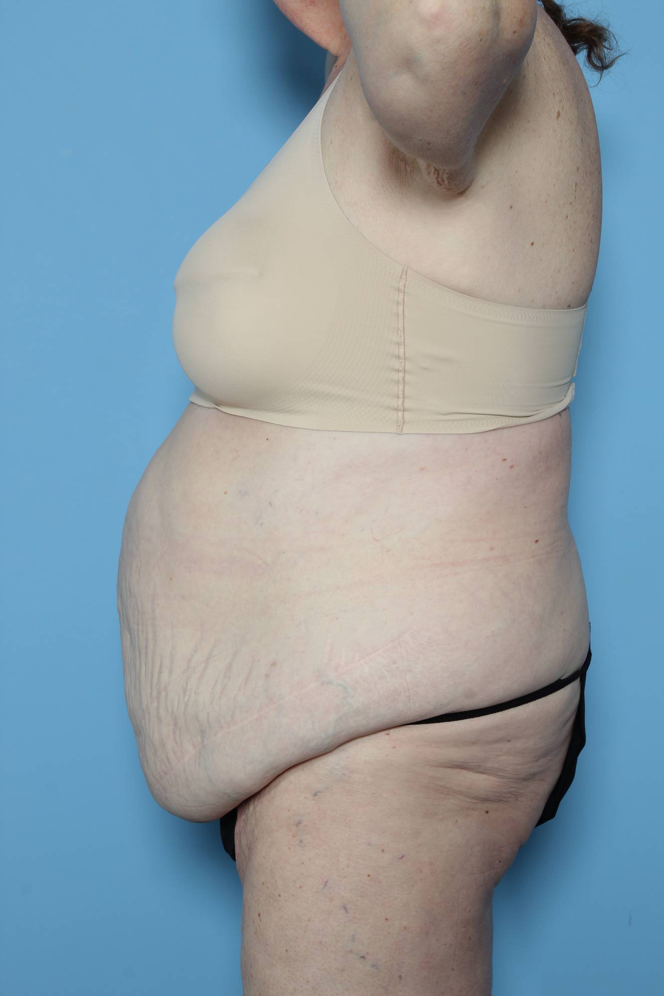 Before & After Image