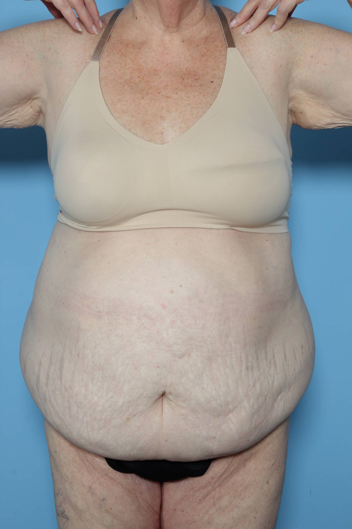 Before & After Image