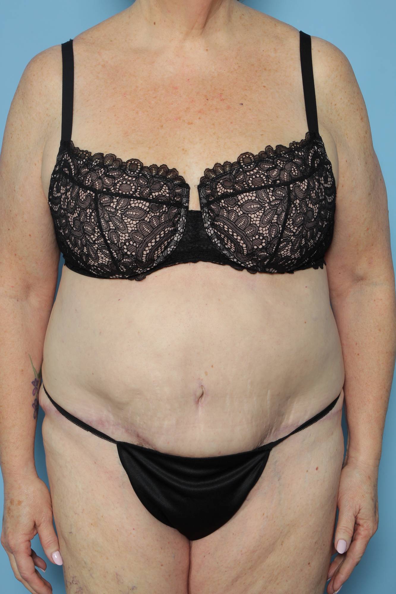 Before & After Image