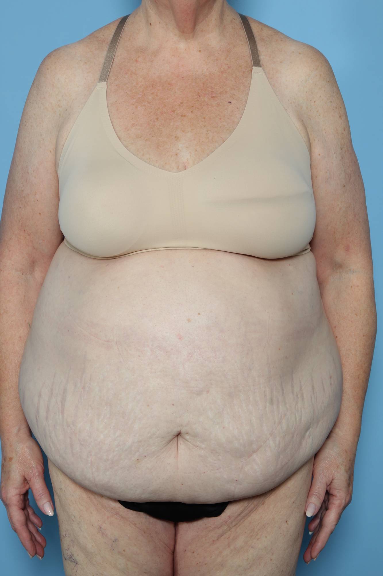 Before & After Image