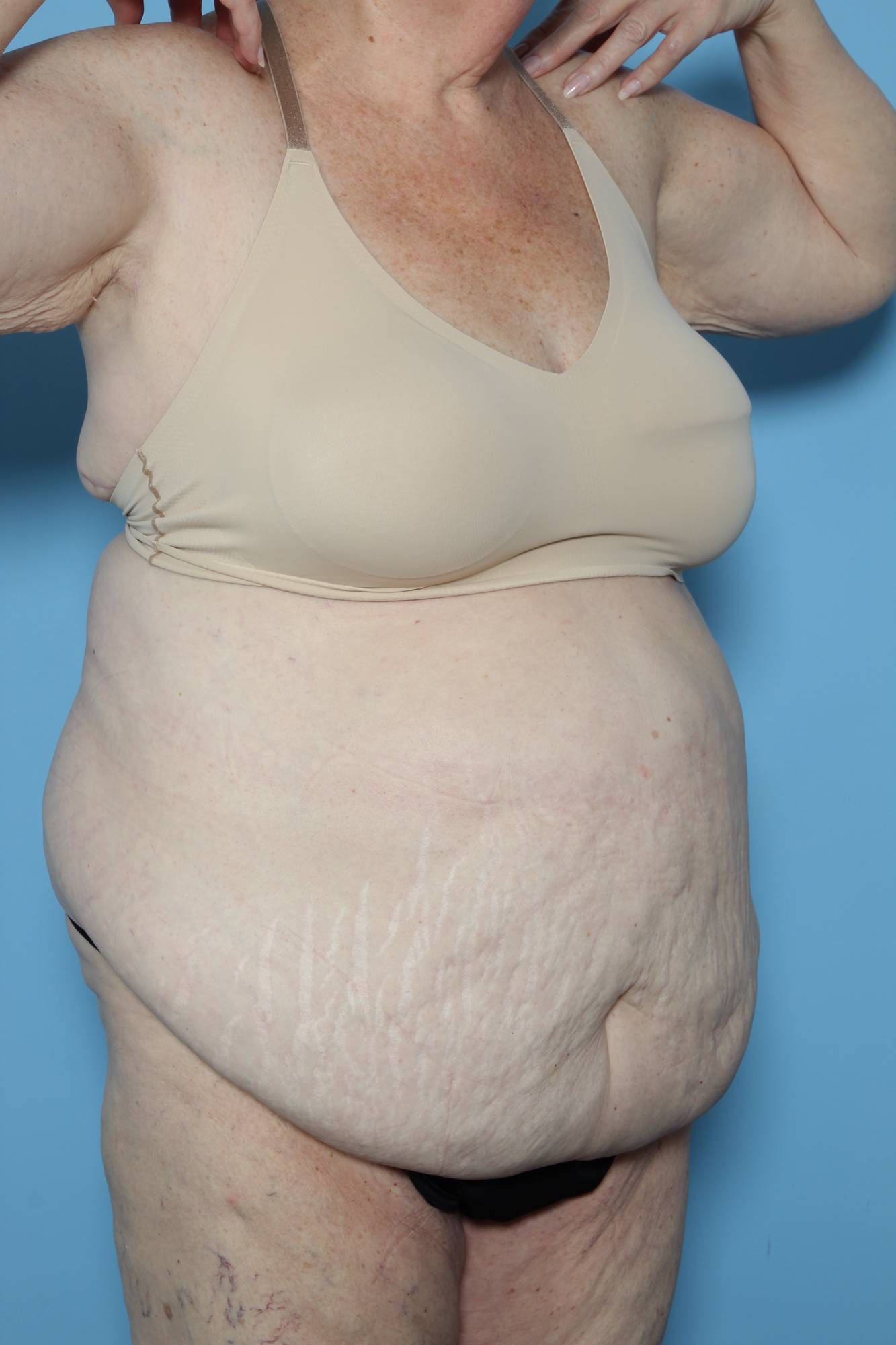 Before & After Image