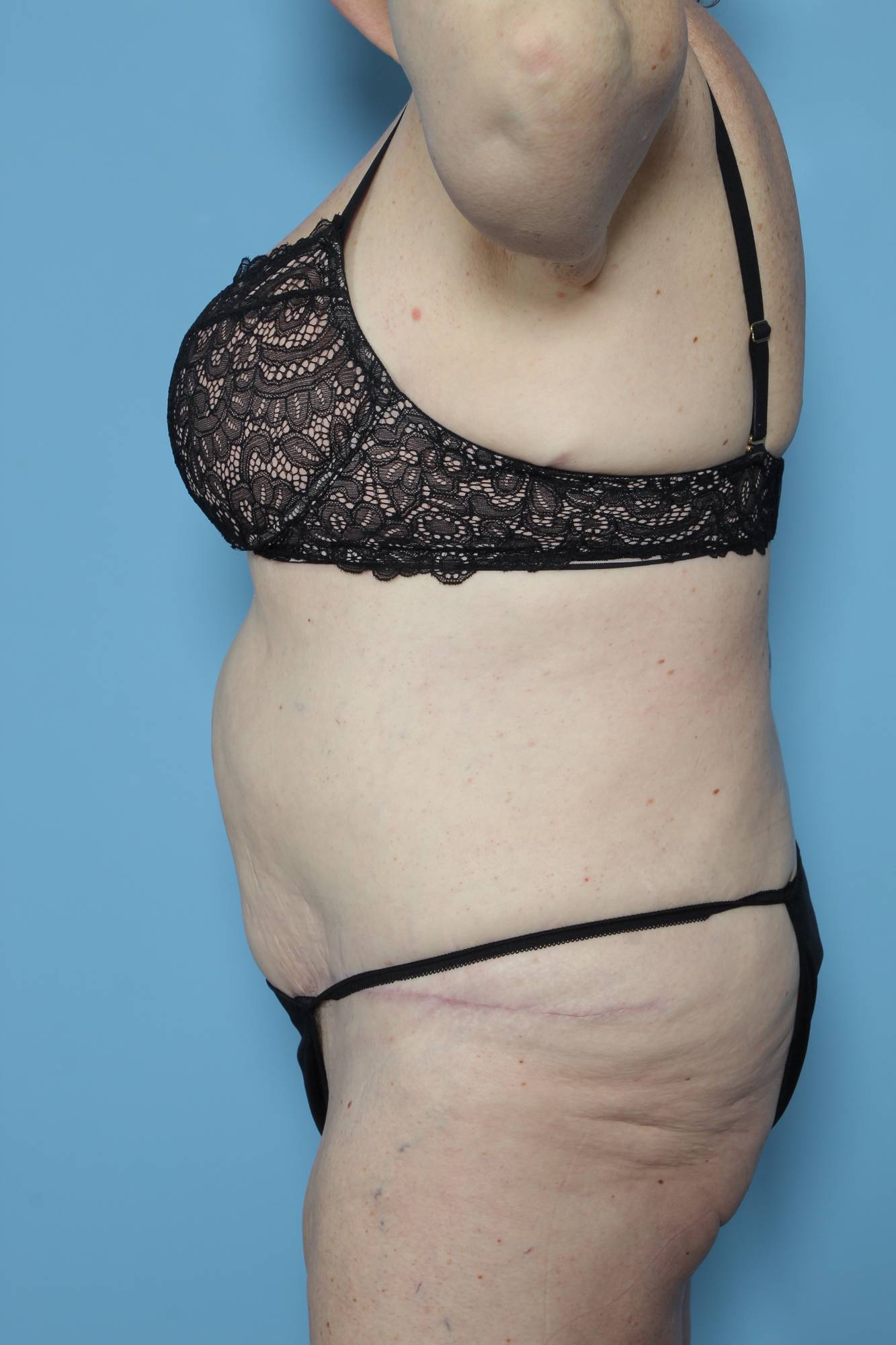 Before & After Image