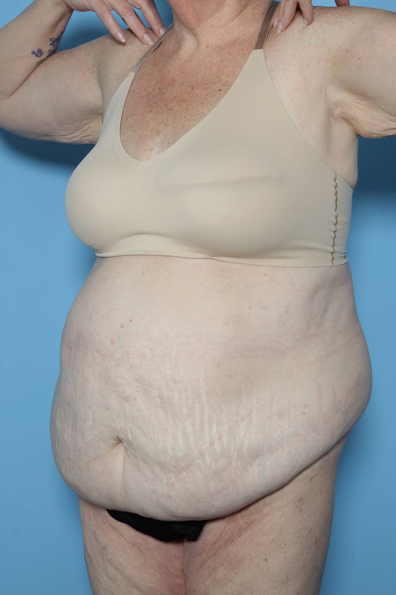 Before & After Image