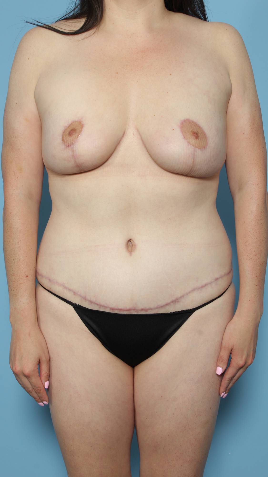 Before & After Image