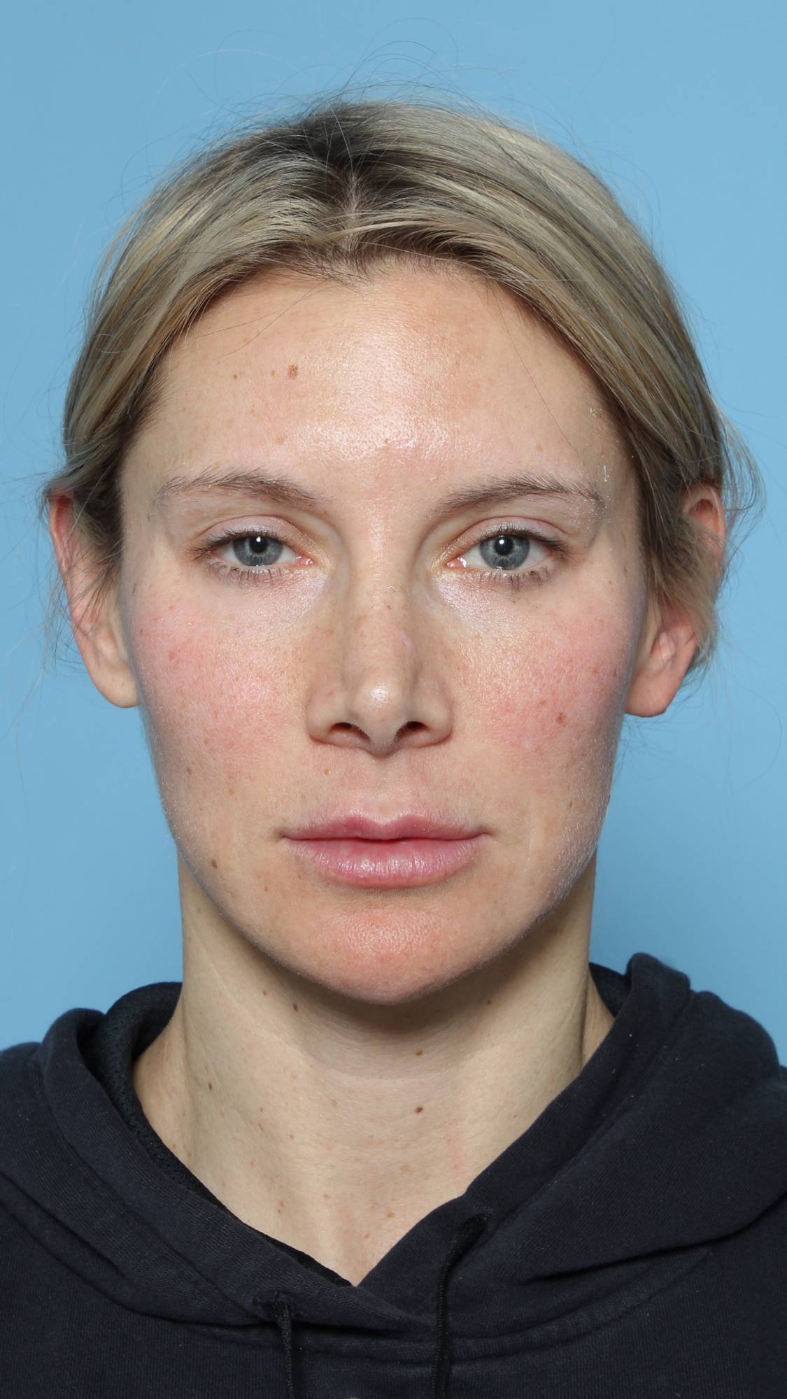 Before & After Image