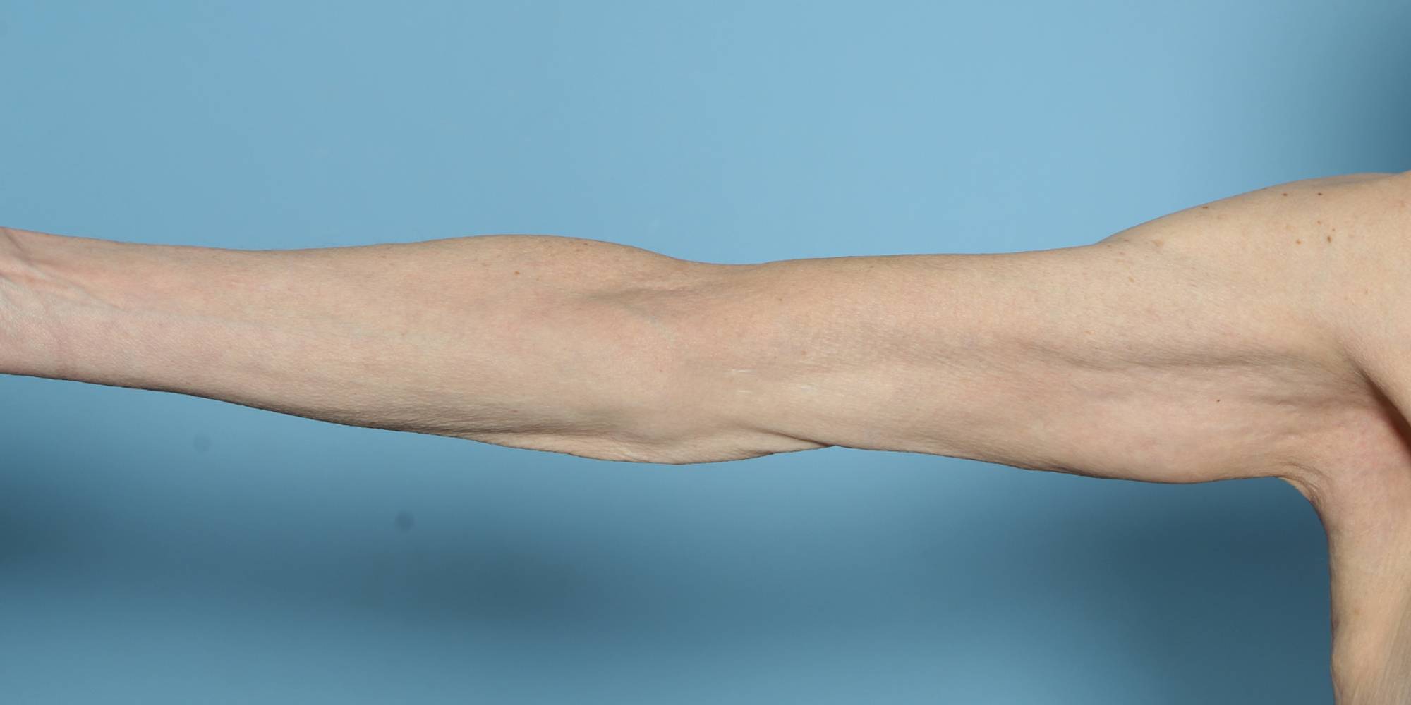 Before & After Image