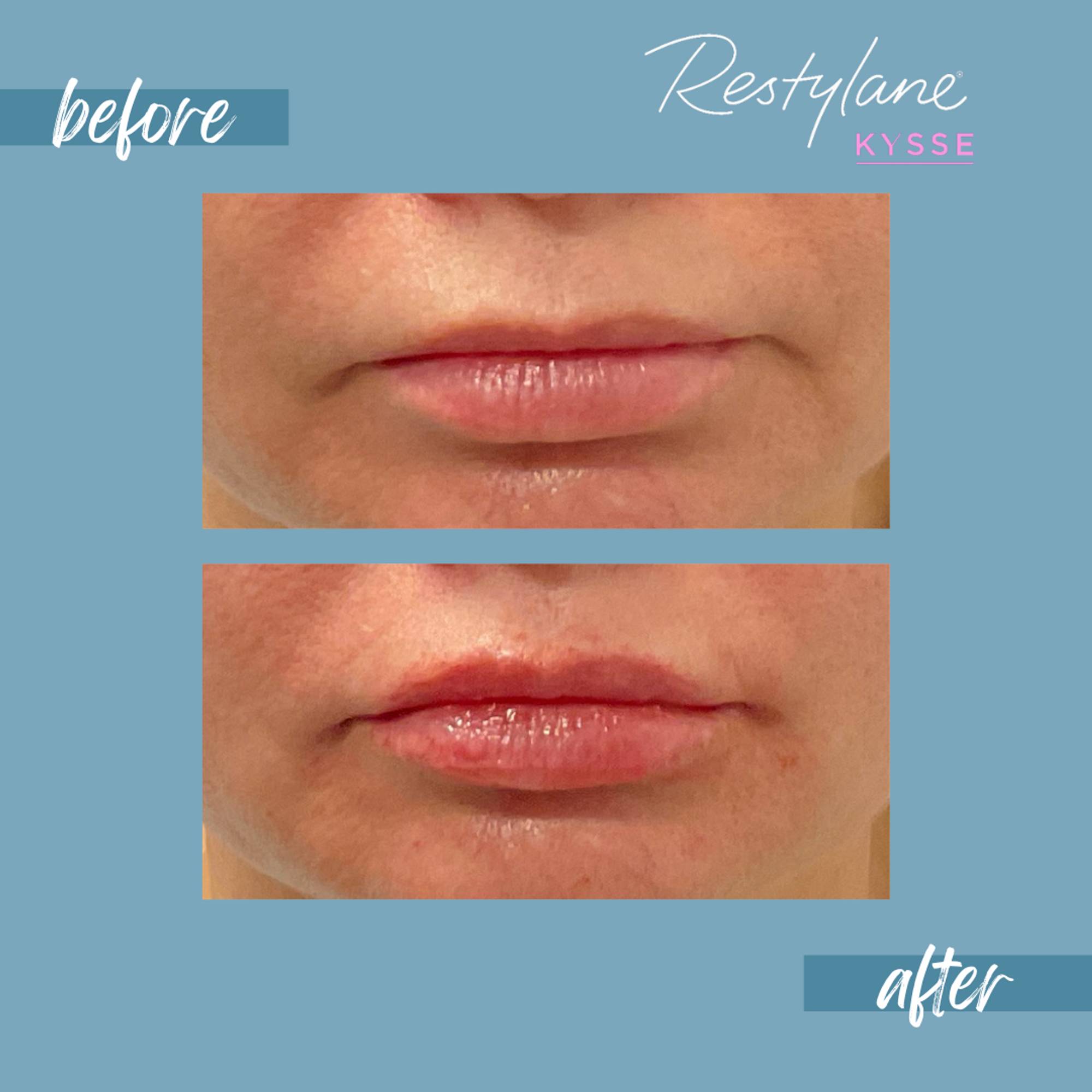 Before & After Image