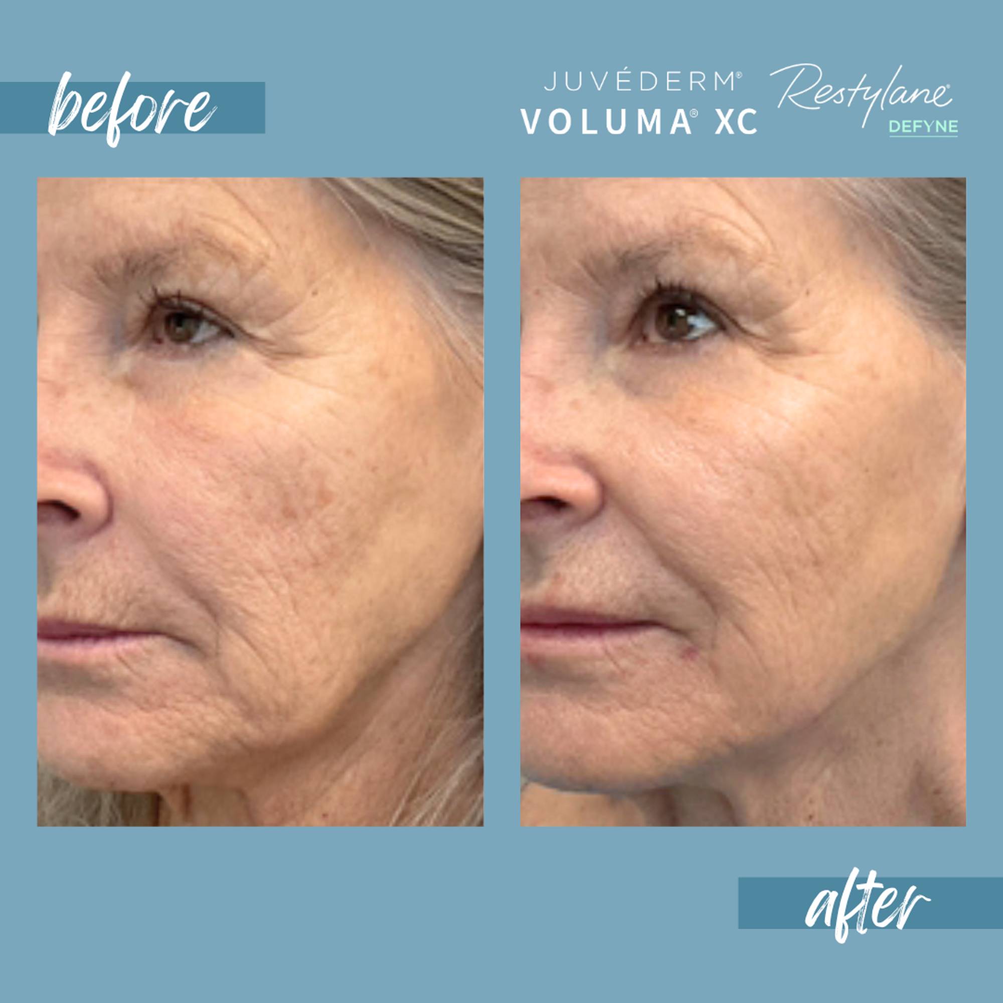 Before & After Image